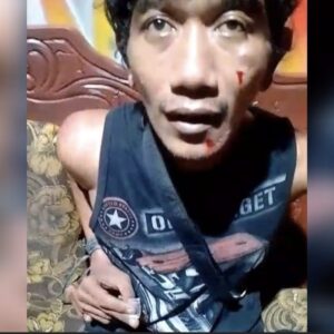 Pelaku Penganiayaan Juanda Masih Bebas Berkeliaran